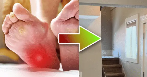 before and after using Akusoli insoles