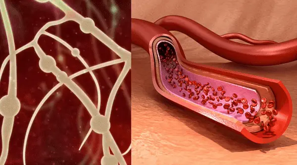 veins explanation creating foot pain